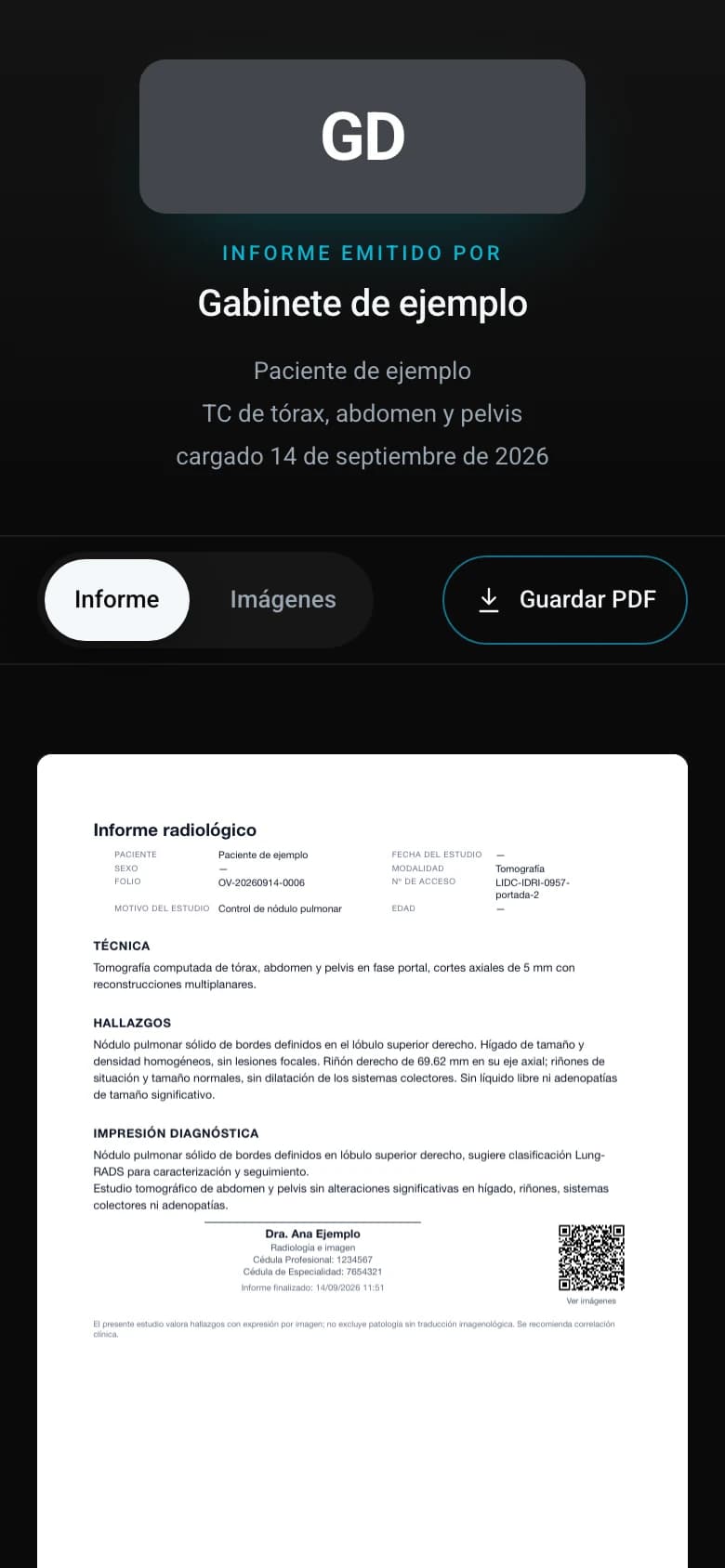 La página que abre el paciente en su teléfono: el informe firmado emitido por el gabinete, con las pestañas Informe e Imágenes y el botón para guardar el PDF.